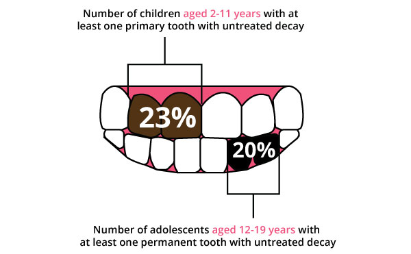 Rate of tooth decay