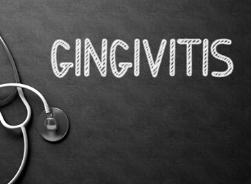Unlocking the Mystery of Problematic ‘P. Gingivalis’