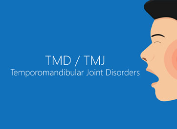 CASE STUDY: Sedation for TMJ Disfunction