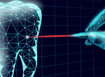 Laser Technology Could Change the Game in Minimally Invasive Dentistry