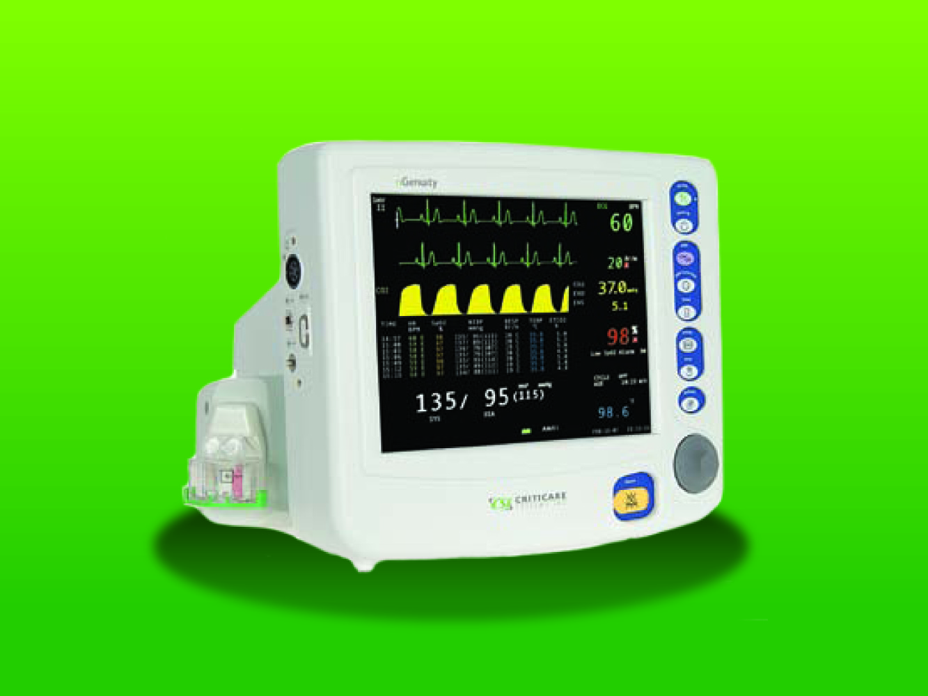 Secure patient safety, sedation success with industry-leading vital signs monitor